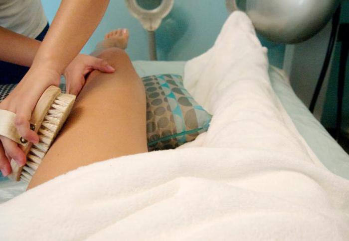 Massage med en tør børste mod cellulite