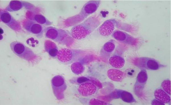 rhinocytogram norm i børn afkodning tabel