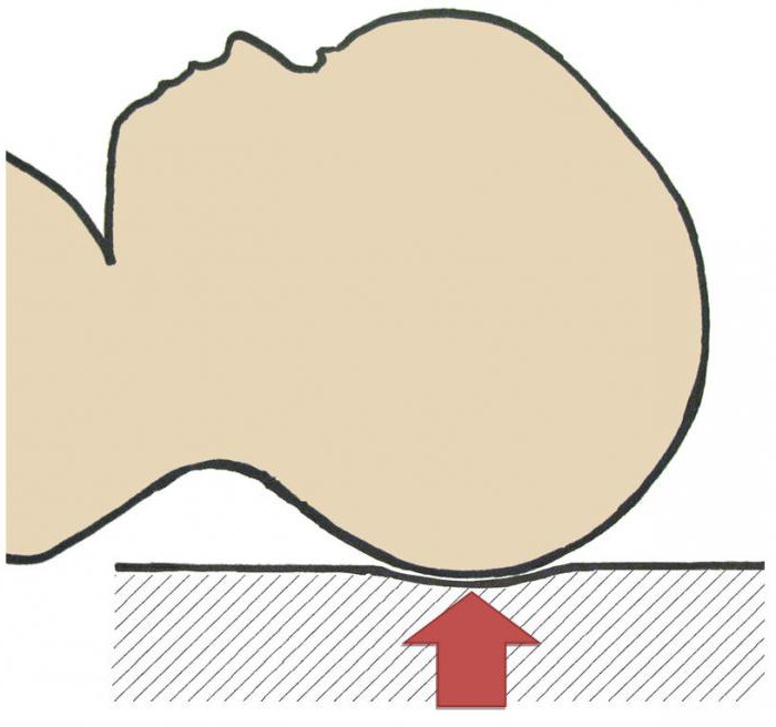 Dolichocephalic form af hovedet: norm og patologi