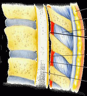 Epidural: hvad er det?