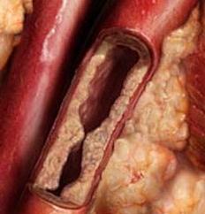 Human Circulation Circles: struktur og rolle i kroppen