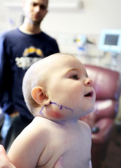 Betændelse af lymfeknuder i halsen i et barn: årsager og behandling